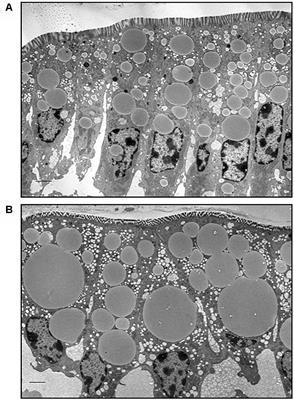 Diet Induced Obesity Alters Intestinal Cytoplasmic Lipid Droplet Morphology and Proteome in the Postprandial Response to Dietary Fat